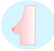 Зауженная форма груди